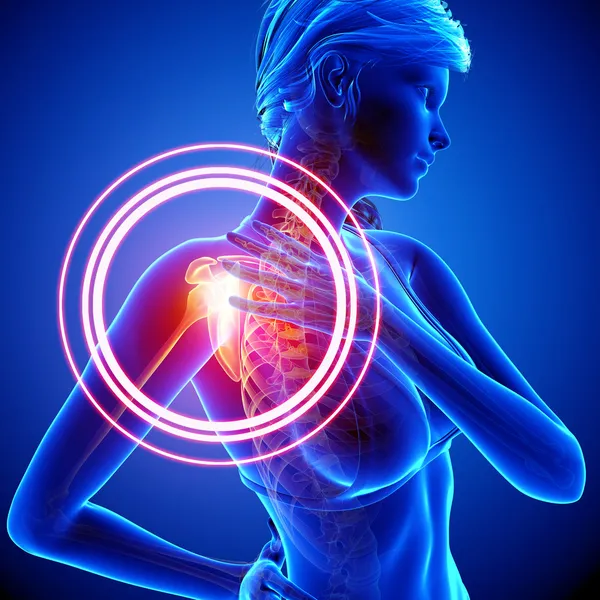 Illustration of shoulder highlighted shoulder pain — Stock Photo, Image