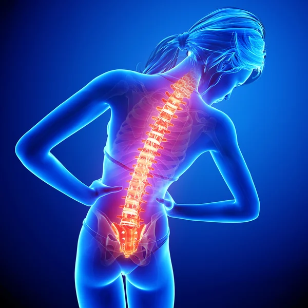 파란색으로 강조 표시 된 척수와 인간의 척추 통증의 그림 — 스톡 사진