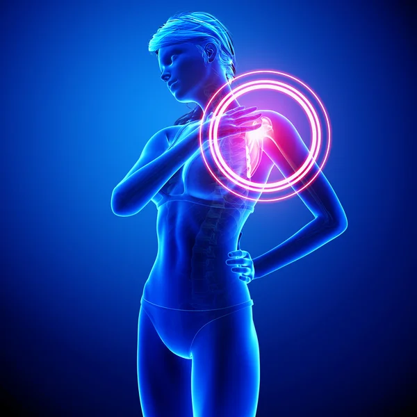 Illustration of shoulder highlighted shoulder pain — Stock Photo, Image