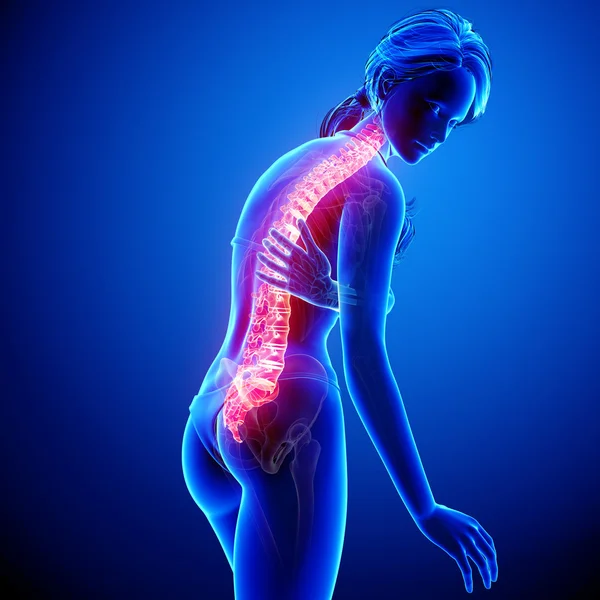 Illustration of human spine pain with highlighted spinal cord in blue — Stock Photo, Image