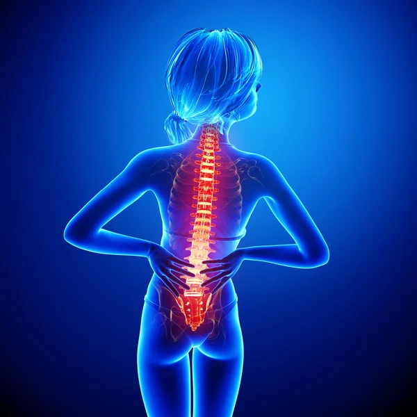 Illustration of human spine pain with highlighted spinal cord in blue — Stock Photo, Image