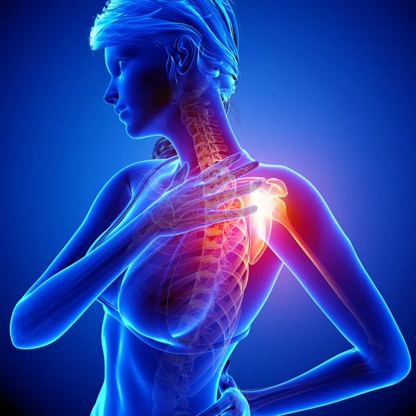 Illustration of shoulder highlighted shoulder pain — Stock Photo, Image
