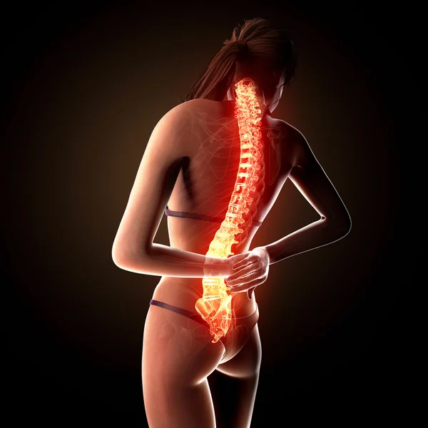 突出显示脊髓人体脊柱疼痛的插图 — 图库照片