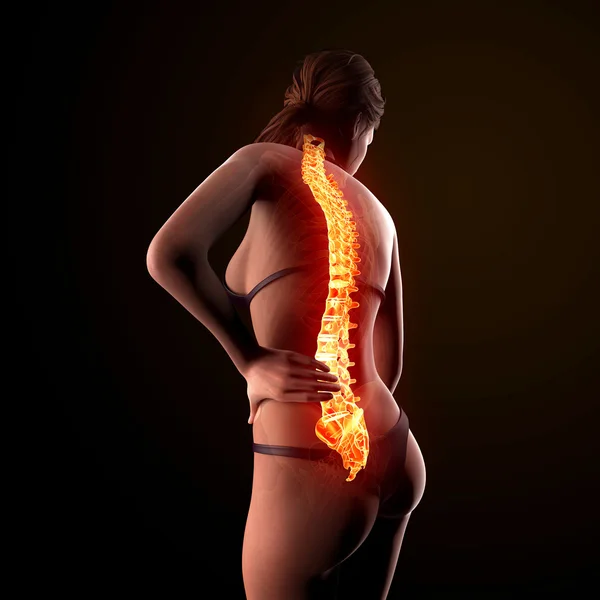 Ilustración del dolor en la columna vertebral humana con la médula espinal resaltada —  Fotos de Stock