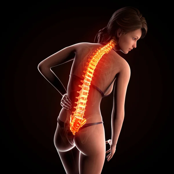 Illustration of human spine pain with highlighted spinal cord — Stock Photo, Image