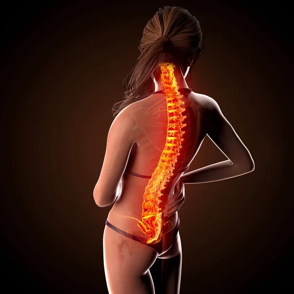 Illustrazione del dolore alla colonna vertebrale umana con midollo spinale evidenziato — Foto Stock