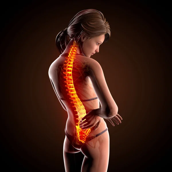 Illustration of human spine pain with highlighted spinal cord — Stock Photo, Image