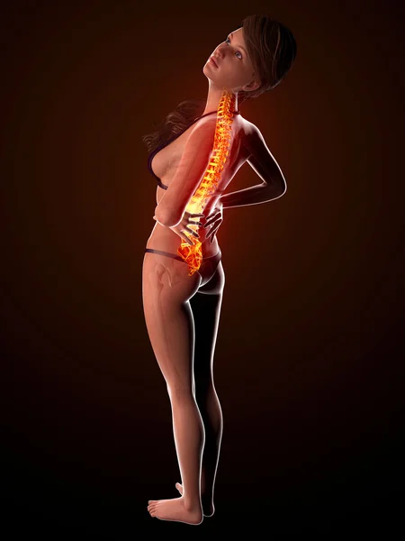 Illustration of human spine pain with highlighted spinal cord — Stock Photo, Image