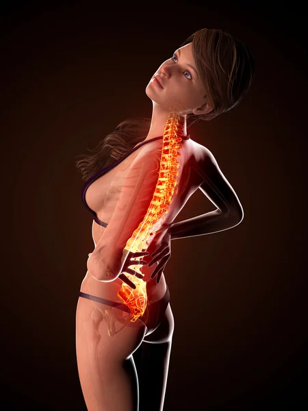 Illustration of human spine pain with highlighted spinal cord — Stock Photo, Image