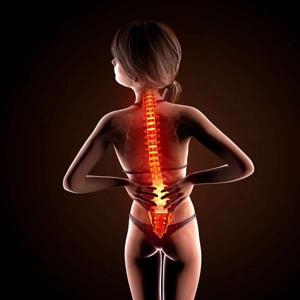 Ilustracja ludzki kręgosłup ból z podświetloną rdzenia kręgowego — Zdjęcie stockowe