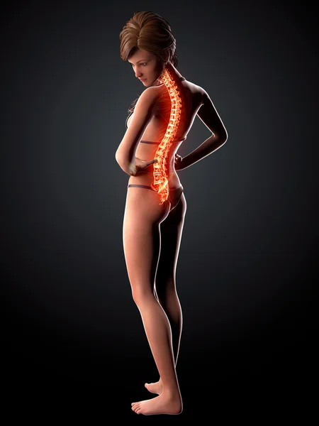 Ilustracja ludzki kręgosłup ból z podświetloną rdzenia kręgowego — Zdjęcie stockowe