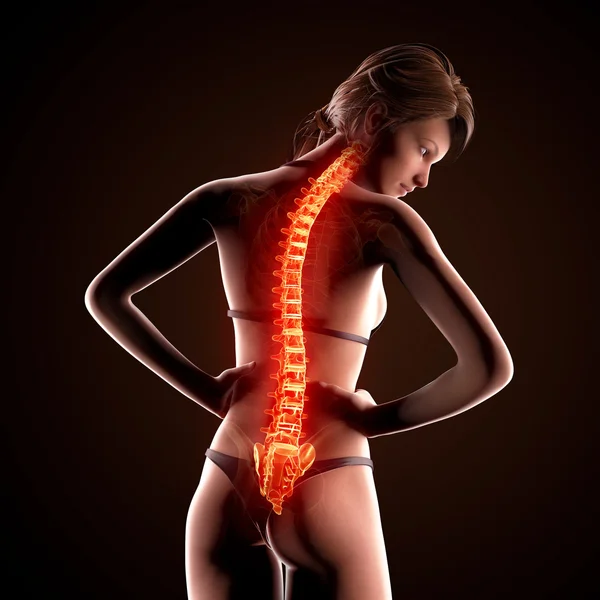 強調表示された脊髄と人間の背骨の痛みのイラスト — ストック写真