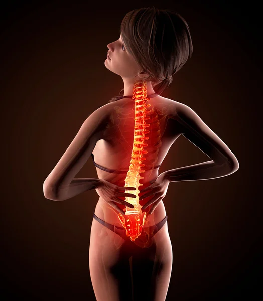 Illustration of human spine pain with highlighted spinal cord — Stock Photo, Image