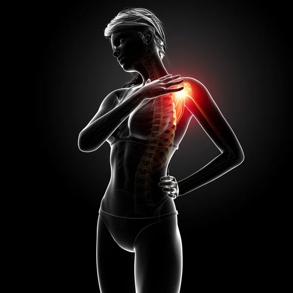 Ilustración del hombro resaltado dolor en el hombro Imagen de stock