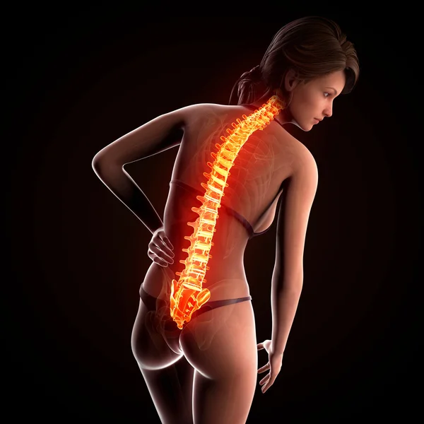 Ilustración del dolor en la columna vertebral humana con la médula espinal resaltada Fotos de stock