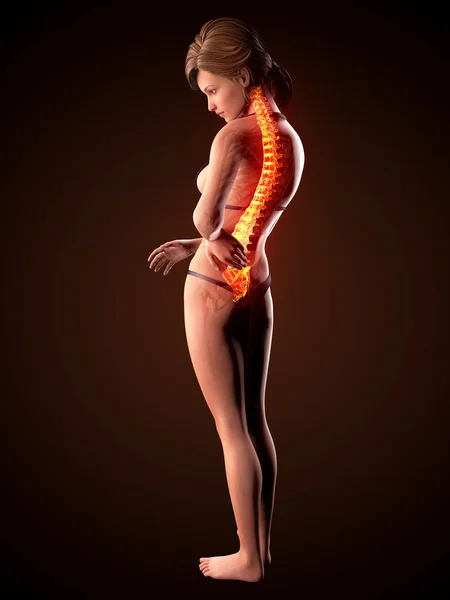 Ilustración del dolor en la columna vertebral humana con la médula espinal resaltada Fotos de stock libres de derechos