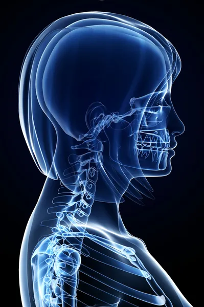 Anatomía dolor de columna vertebral femenina —  Fotos de Stock