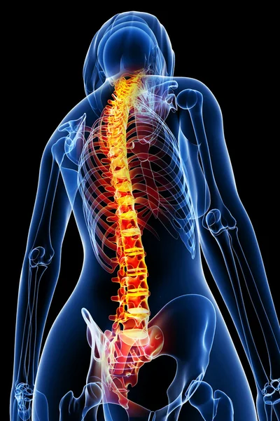 Kadın omurga ağrısı x-ray anatomisi — Stok fotoğraf