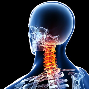X-ray of neck pain clipart
