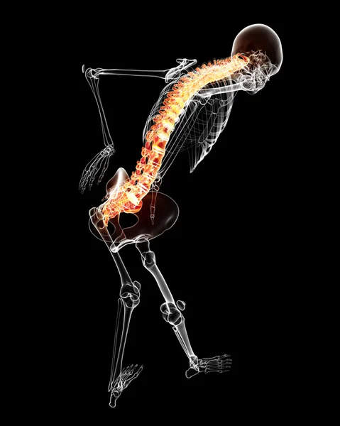 Anatomia ból z powrotem — Zdjęcie stockowe
