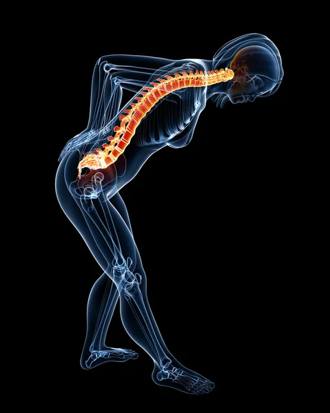 Kobieta kręgosłupa ból x-ray anatomii — Zdjęcie stockowe
