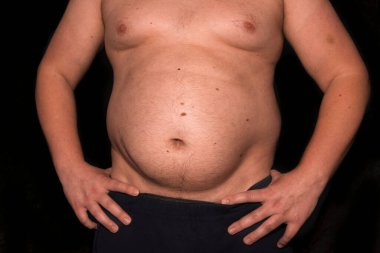 Karın şişmanlığı ve geniş bir göbeği olan bir adamın çıplak gövdesi. Sağlıksız yaşam tarzı ve kilo verme kavramı. Sağlık sorunları, kilo sorunları, obezite, aşırı yeme, depresyon, güvensizlik