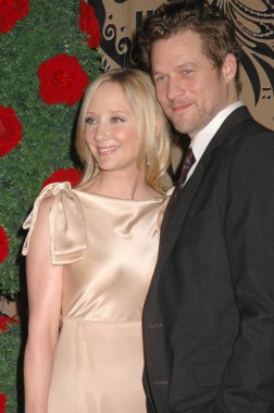 Anne Heche, James Tupper