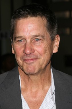 Tim Matheson