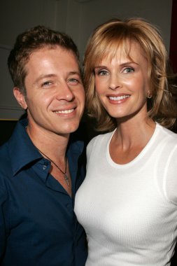 kylie bax saç bitmiş olması