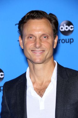 Tony goldwyn