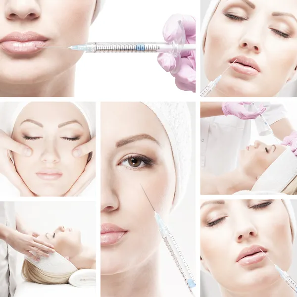 Collage composé de différentes images avec les injections de botox — Photo