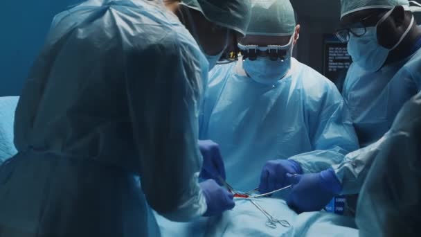 Multiracial team of professional medical surgeons performs the surgical operation in a modern hospital. Doctors are working to save the patient. Medicine, health, cardiology and transplantation. — Stock Video