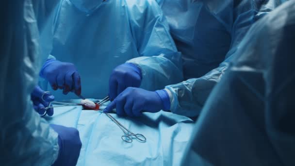 El equipo multirracial de cirujanos médicos profesionales realiza la operación quirúrgica en un hospital moderno. Los médicos están trabajando para salvar al paciente. Medicina, salud, cardiología y trasplante. — Vídeo de stock