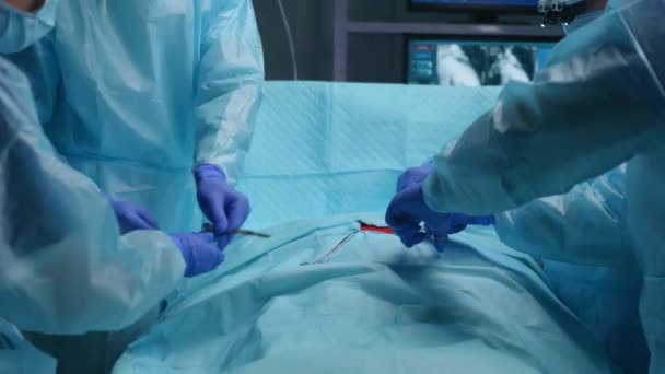 Egy csapat hivatásos orvosi sebész végzi a műtétet egy modern kórházban. Az orvosok azon dolgoznak, hogy megmentsék a beteget. Gyógyászat, egészségügy, kardiológia és transzplantáció. — Stock videók