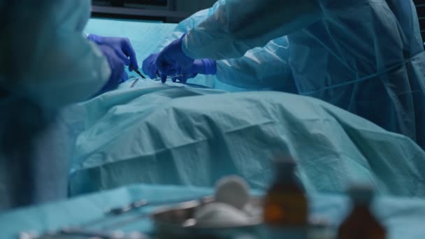 Profesyonel tıp cerrahlarından oluşan bir ekip modern bir hastanede cerrahi operasyon gerçekleştiriyor. Doktorlar hastayı kurtarmaya çalışıyor. Tıp, sağlık, kardiyoloji ve organ nakli kavramı. — Stok video