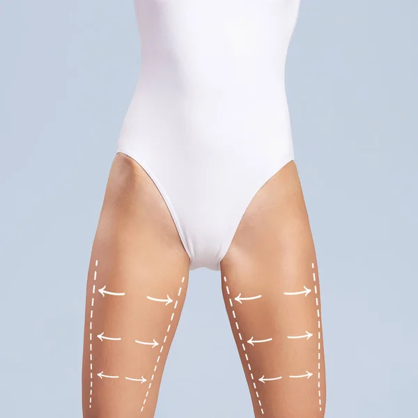 Schöner und fitter weiblicher Körper mit den Zeichnungspfeilen. Plastische Chirurgie, gesunde Ernährung, Fettabsaugung, Sport und Entfernung von Cellulite. — Stockfoto