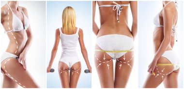 Female body with the drawing arrows on it. The concept of fat lose, liposuction and cellulite removal.