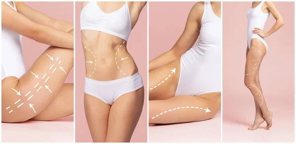 Mooi Fit Vrouwelijk Lichaam Met Tekening Pijlen Plastische Chirurgie Liposuctie — Stockfoto