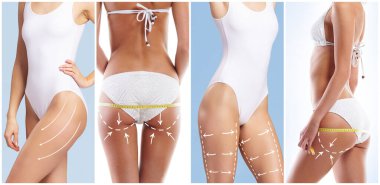 Female body with the drawing arrows on it. The concept of fat lose, liposuction and cellulite removal.