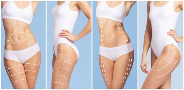 güzel ve sağlıklı kadın vücut çizim oklar. plastik cerrahi, sağlıklı beslenme, liposuction, spor ve selülit Temizleme kavramı.