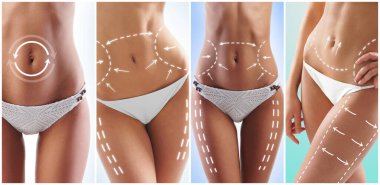 güzel ve sağlıklı kadın vücut çizim oklar. plastik cerrahi, sağlıklı beslenme, liposuction, spor ve selülit Temizleme kavramı.