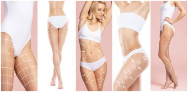 Female body with the drawing arrows on it. The concept of fat lose, liposuction and cellulite removal.