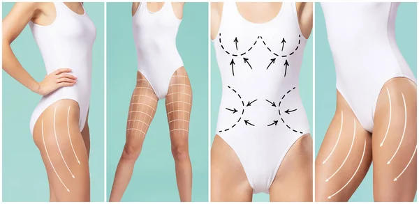 Female Body Drawing Arrows Concept Fat Lose Liposuction Cellulite Removal — Foto de Stock