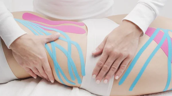 Therapist Applying Tape Beautiful Female Body Physiotherapy Kinesiology Recovery Treatment — Stok fotoğraf