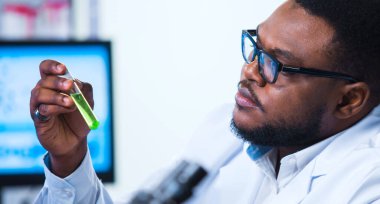 Modern Fütürist Laboratuvarında Maymun Çiçeği Araştırması Yapan Profesyonel Doktorlar. Klinik Hastanesi 'nde laboratuvar deneyleri. Bilim ve Tıp Konsepti.