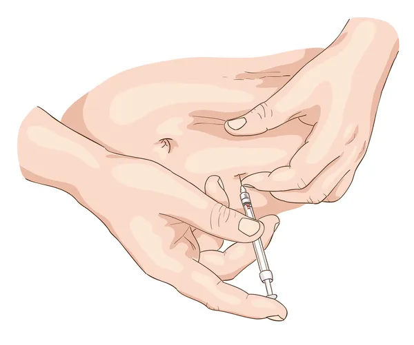 bir bel bölgende insülin enjeksiyonu.