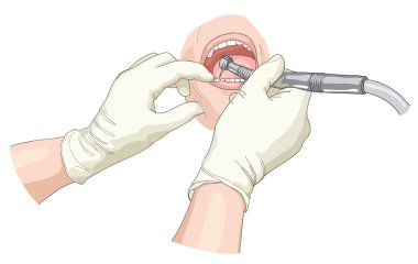 Treatment at the stomatologist. clipart