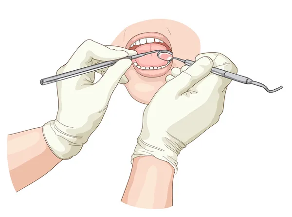 Traitement chez le stomatologue . — Image vectorielle