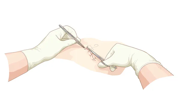 cerrah bir yara alır..