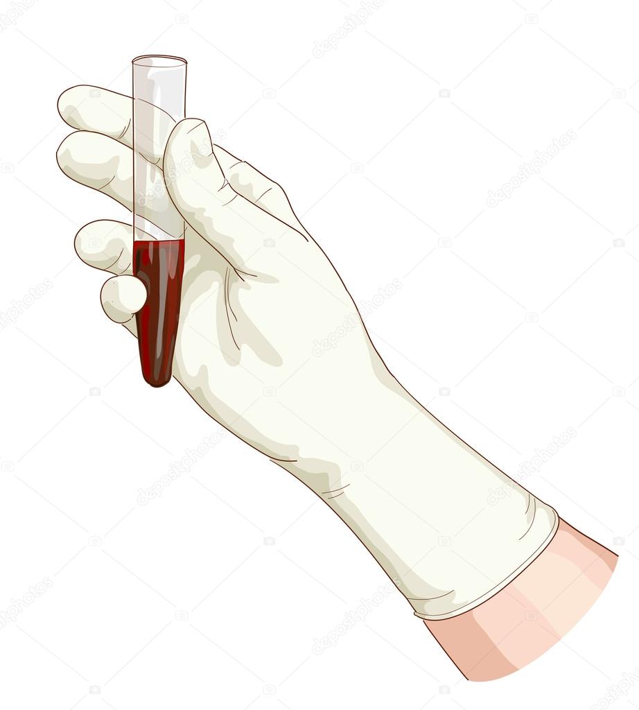 Blood in a test tube.